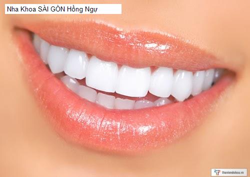 Hình ảnh Nha Khoa SÀI GÒN Hồng Ngự